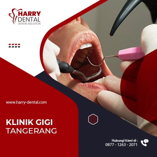 Klinik Gigi Tangerang
